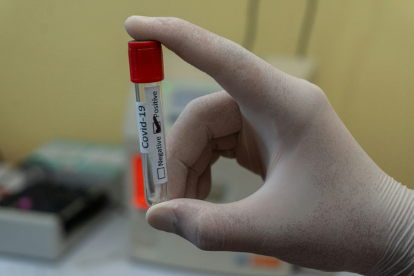 COVID-19 vaccine policy: a response and way forward