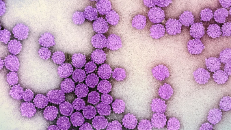 Guidelines Expanded for Cervical Cancer Screening to Include Self-Swab HPV Test