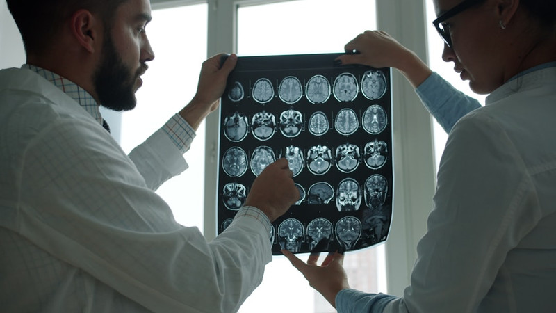 Quick brain injury treatment cuts Alzheimer’s risk, study finds