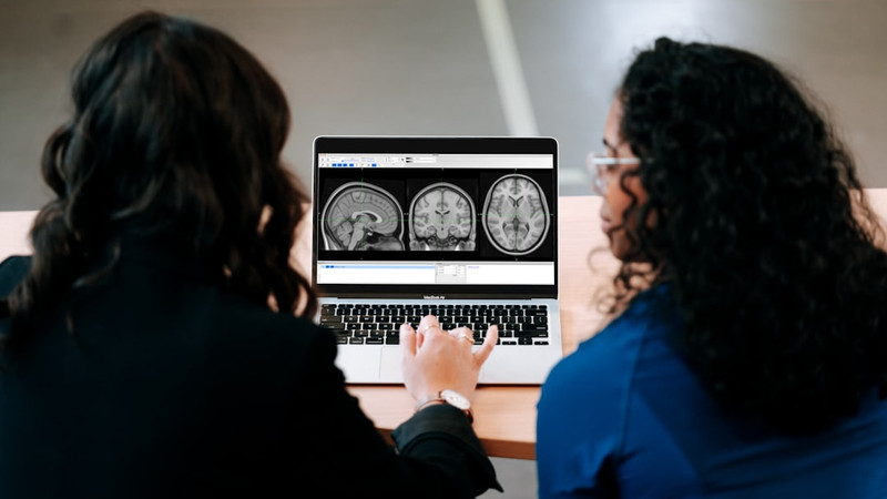 AI tool predicts Alzheimer’s disease with nearly 93% accuracy using brain scans