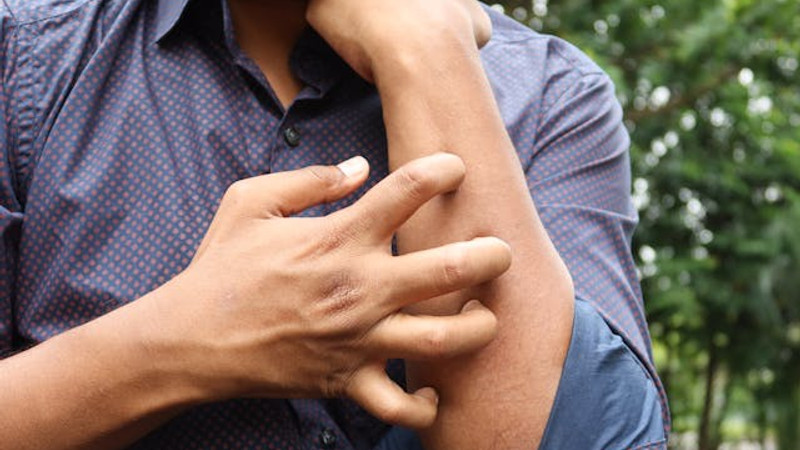 Scientists May Have Found The Brain’s Hidden “Stop Scratching” Switch