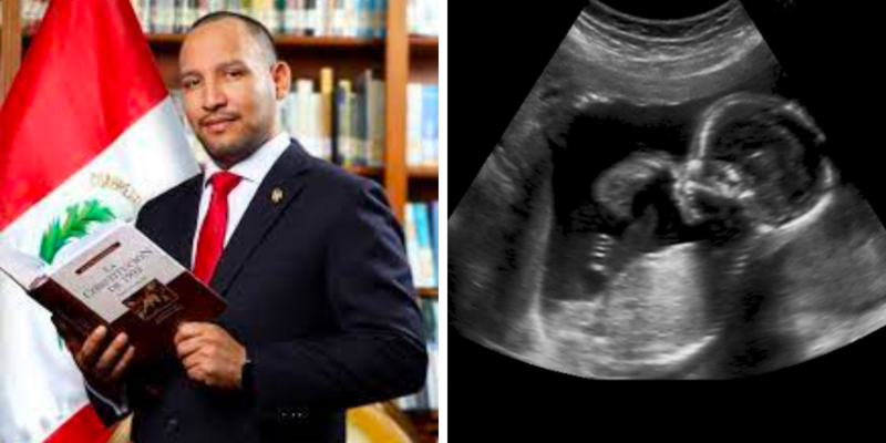 Peru grants constitutional rights to unborn babies with 'rights of the conceived' law 