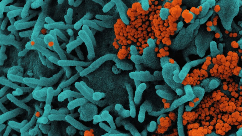 5 Louisiana residents infected with flesh-eating bacteria in 2026 have died