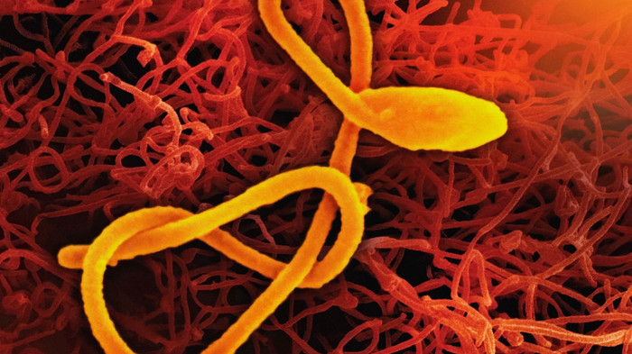 Trump to send Ebola patients to Kenya