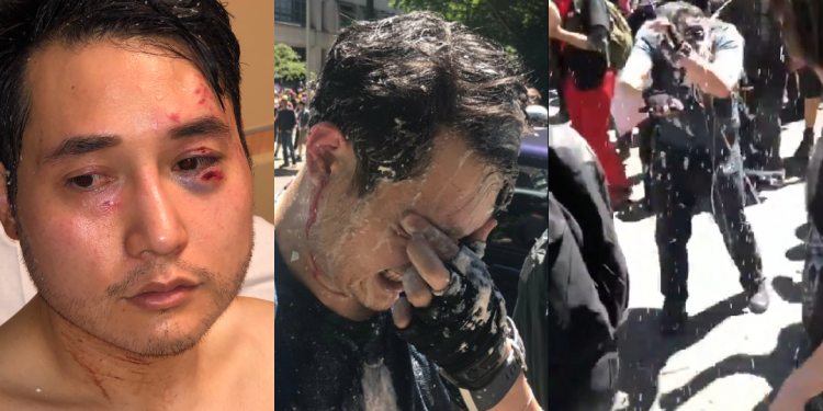 Progressivist “blue check” journalists celebrate the assault of Andy Ngo