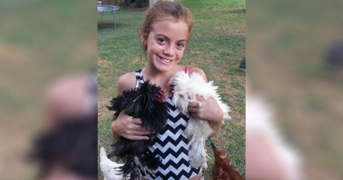 Ten-year old Texas girl dies from brain-eating amoeba