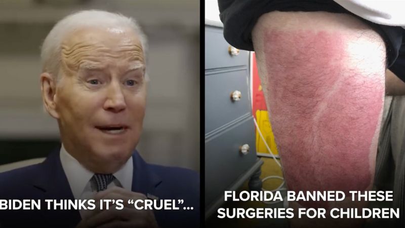 DeSantis releases graphic video showing sex change surgeries after Biden calls Florida's ban on child sex changes 'sinful'