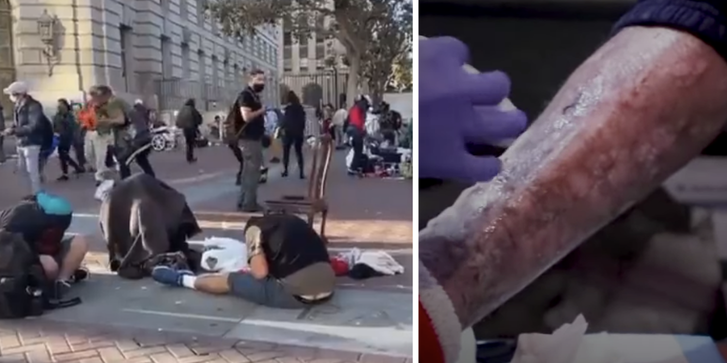 FLESH-EATING drug 'tranq' spreads across the US, commonly laced with fentanyl