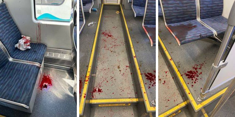 One person attacked with rock, another stabbed on Seattle light rail