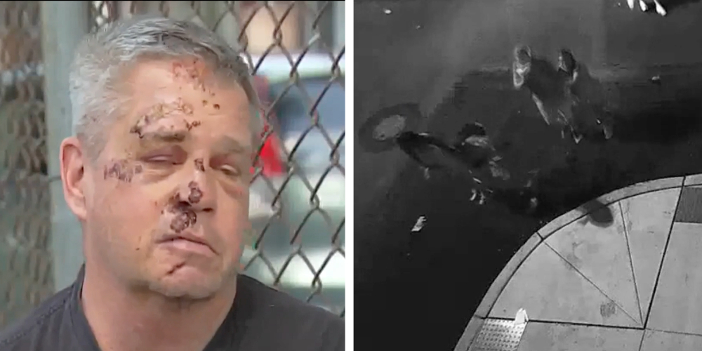 Navy veteran left with brain injury after brutal attack while walking dog in Philadelphia