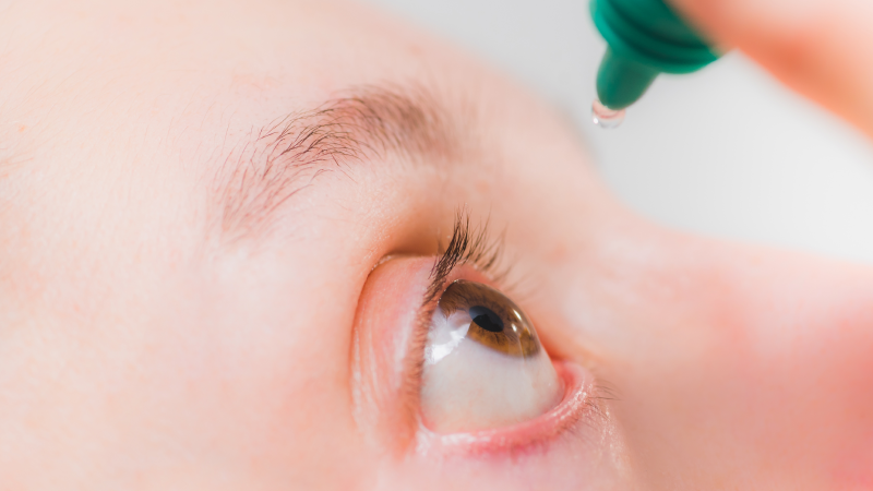 Woman Glues Eyes Shut After Mistaking Glue For Eyedrops