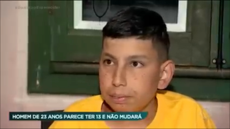 Rare Condition Makes Grown Man Look Like a 13-Year-Old Boy