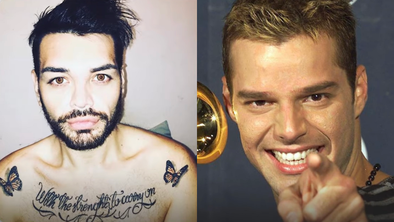 This Guy Has Undergone 30 Surgeries to Look Like Ricky Martin and He’s Not Even Close