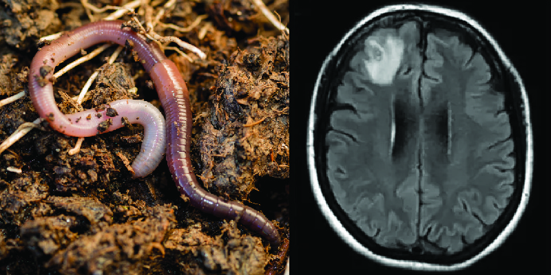 World’s First Discovery of a LIVE Worm Living in a Person’s Brain