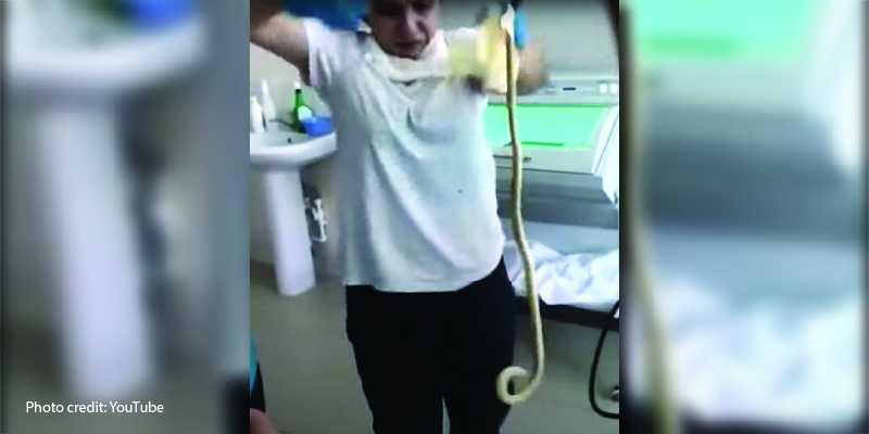 VIDEO: 4-Feet of 'Snake' Removed from Woman’s Stomach