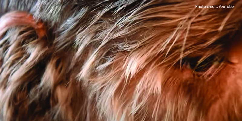 This Little Girl Was Born With 'Werewolf' Syndrome