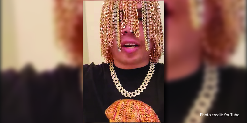 Man Surgically Implants Gold Chains into His Head As 'Hair'