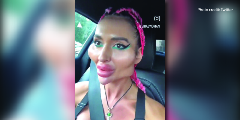 Why On Earth Are Women Doing This to Themselves?