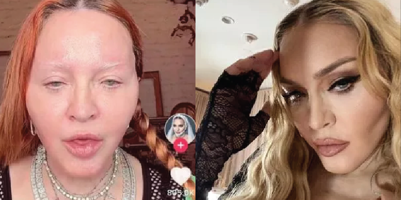 Photos of a 'Filterless' Madonna Reveal What She REALLY Looks Like and Fans Are Genuinely Scared