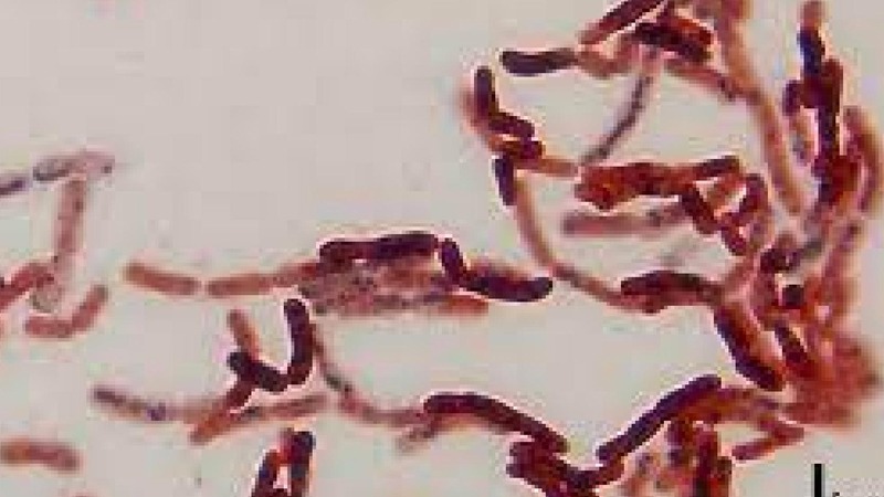 Russian Scientist injects Himself With 3.5-Million-Year-Old Bacteria So He Can Live Forever 